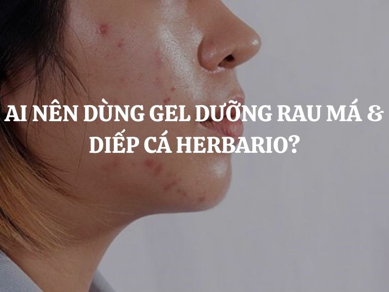 Ai nên dùng Gel dưỡng rau má & diếp cá HERBARIO? Ai không nên dùng?